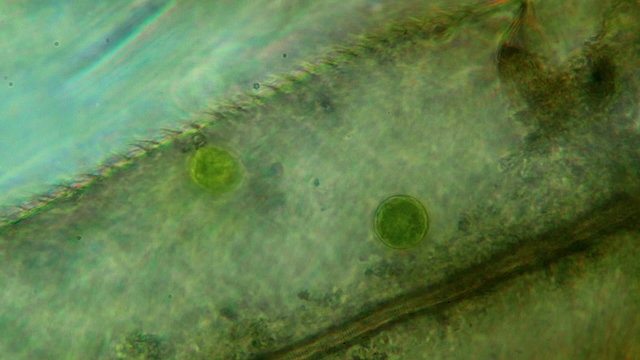 Two Round Protozoa specimens feeding inside an Insect Leg 400x Microscope