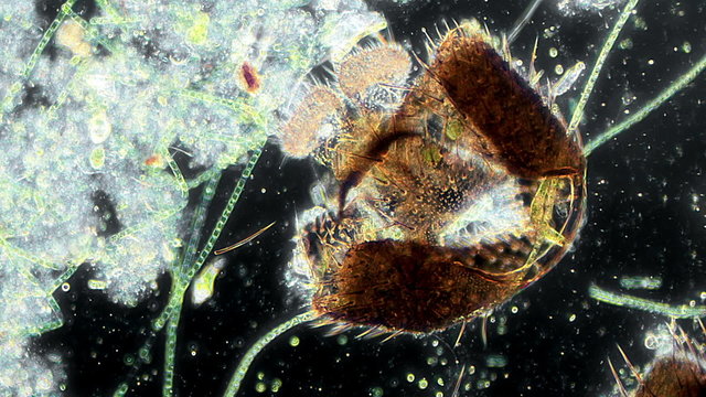 Fruit Fly Eaten by Bacteria And Nematode Worms 300x