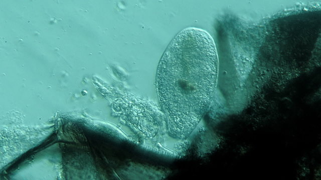 Ciliate Protozoa Specimen Rotating and Ingesting near insect flesh specimen 800x.