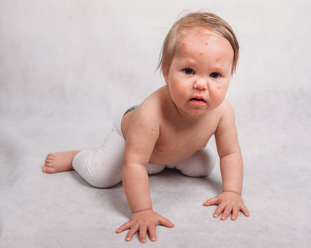 Sick baby