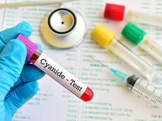 Test tube with blood sample for cyanide test
