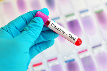 Fototapeta premium Test tube with blood sample for cyanide test 