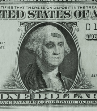 George Washington on a dollar bill is sporting a black eye and a band-aid, as the weak dollar takes a beating.