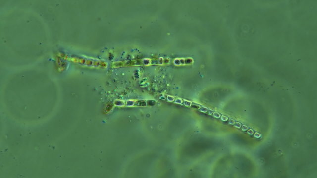 Moss Sample With Symbiotic Bacteria Seen at 400x