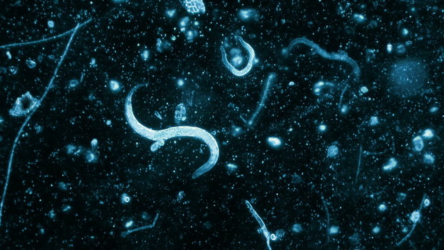Three Nematode Worms Seen In Dark Field Microscope With Blue Filter 200x