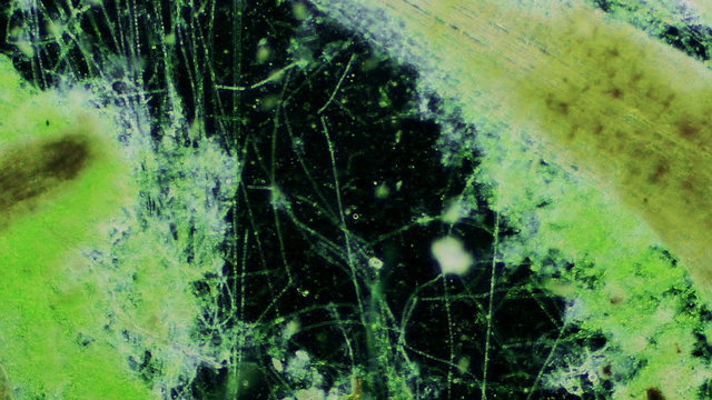 Symbiotic Bacteria living in Moss - Dark Field Microscope 400x