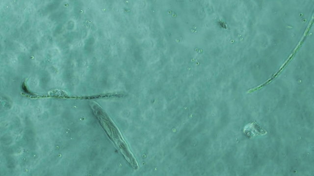 Nematode Worm Squishing and Swimming In Microscope Sample at 200x