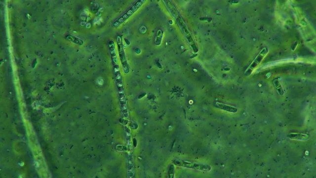 Bacteria Colony On Moss Plants Seen Feeding And Swimming with Protozoa
