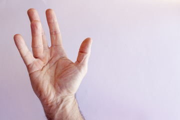 Hand of an man with Dupuytren contracture  disease, against  bright background, isolated 
