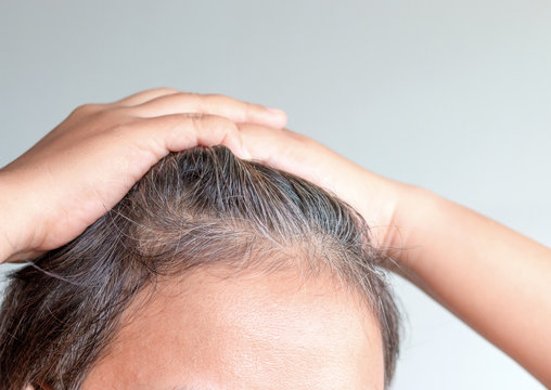 Blurred Of Going Gray In Young Woman Shows Her Gray Hair, Hair G