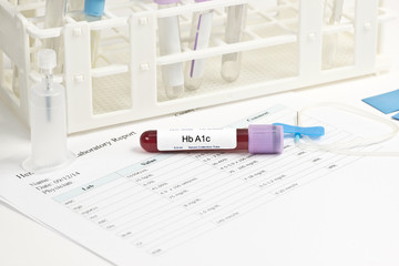 A1c Lab Blood Sample