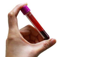 Hand  holding blood sample on white background