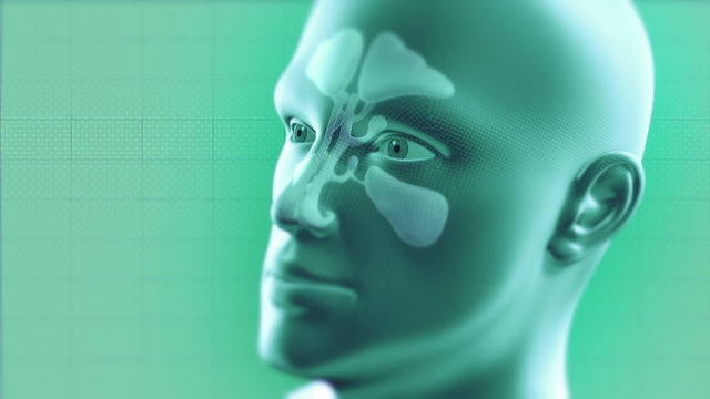 Nasal Sinus Infection Cured by Medicne. Frontal, Ethmoidal, Sphenoidal and Maxillary Sinuses. Sinusitis. 4k - Ultra HD.