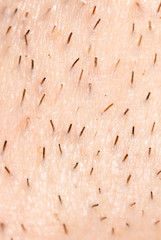 the bristles on the skin. macro