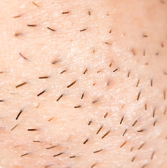 the bristles on the skin. macro