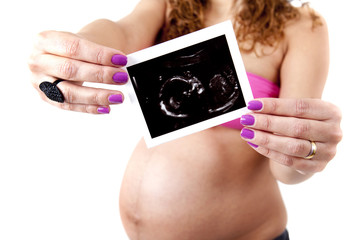 Woman holding an ultrasound scan of her unborn baby