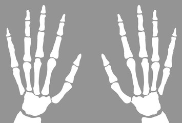 X-Ray Of Hands