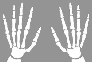 X-Ray Of Hands