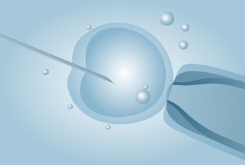 Microscopic artificial insemination, In vitro fertilisation IVF