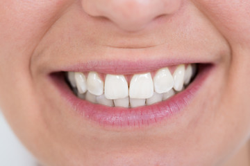 Female Smiling With Healthy White Teeth