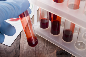 Tubes of blood as the blood test