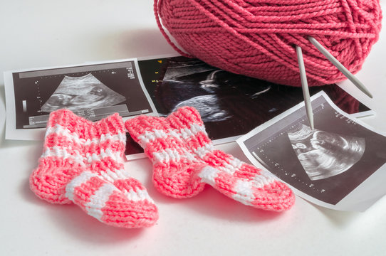 Expecting baby concept. Ultrasound pictures and knitting shoes for baby girl.
