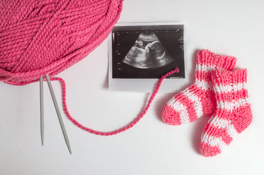 Knitting for baby in pregnancy and ultrasound picture.