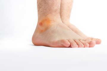 Men's foot
