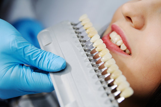 choose the color of the teeth