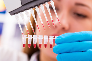 woman assistant in laboratory with multi pipette in the clinic,