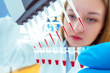 woman assistant in laboratory with multi pipette in the clinic,