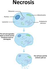 Necrosis Diagram