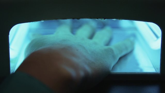 The drying of shellac under UV light