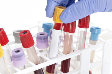 Blood Collection Tube