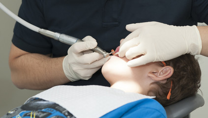 Visiting the dentist having a checkup, clean and work done. Close up images of the dentist working on and in a mouth