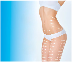 The cellulite removal plan. White markings on young woman body 