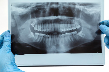 Dental X-ray. Radiography on white background