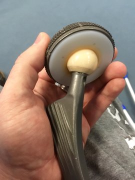K&uuml;nstliches H&uuml;ftgelenk zur Anschauung