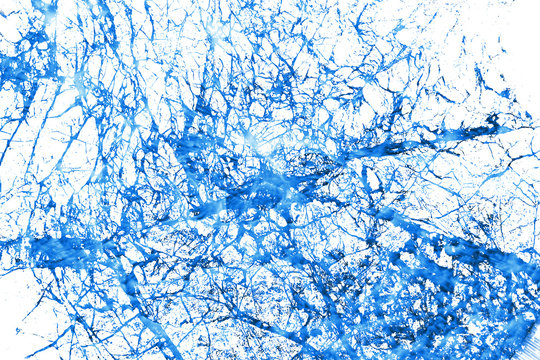 Neural Tissue - Artificial Neural Network - Recurrent Neural Network - Medical Background - Abstract Illustration