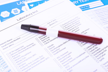 Blood in test tubes and investigation form on the table, close-up