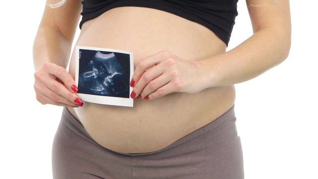 Pregnant woman holding an ultrasound scan of her baby, white, closeup