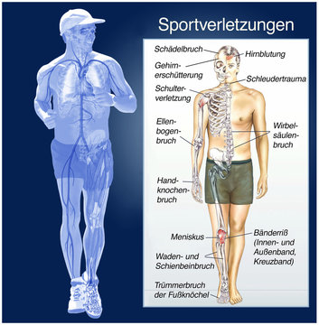 Sportverletzungen