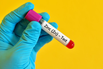 Obraz premium Blood sample for Zinc test 