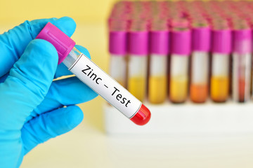 Blood sample for Zinc test
