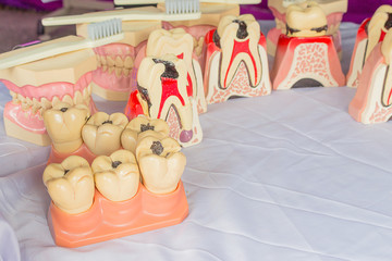 Denture material on a table plastic