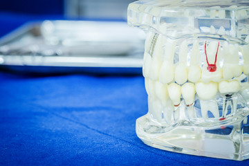 Close up of dental model and teeth x-ray.
