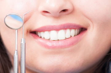 Close up of woman perfect smile with dental equipment