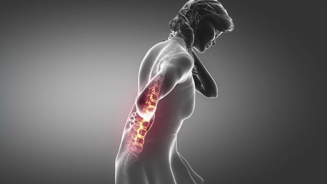Female backbone hurt injury -  spine concept