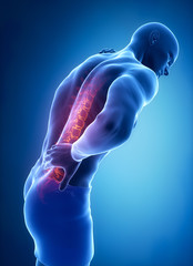 Spine injury pain in sacral and cervical region concept