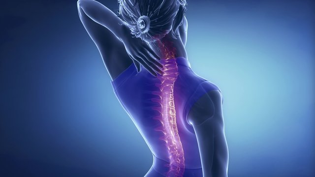 Female backbone pain - spine injury concept in blue